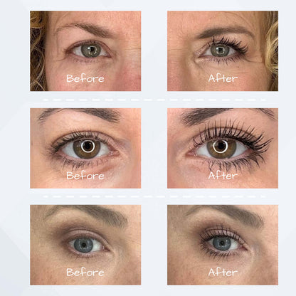 Best Hypoallergenic Mascara For Sensitive Eyes